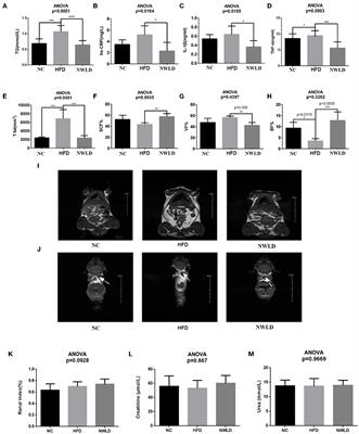 Novel weight loss diet attenuates dietary-induced obesity in mice and might correlate with altered gut microbiota and metabolite profiles
